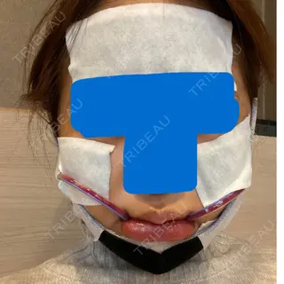 2日目の経過画像（1枚目）