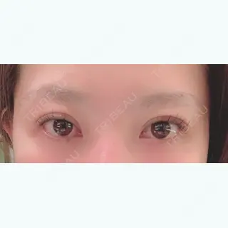 11日目の経過画像（1枚目）