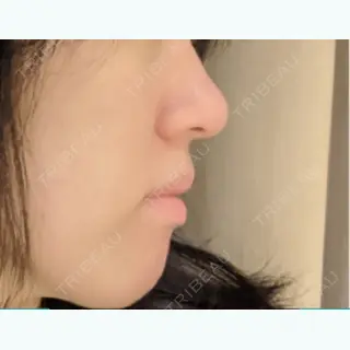 9日目の経過画像（2枚目）