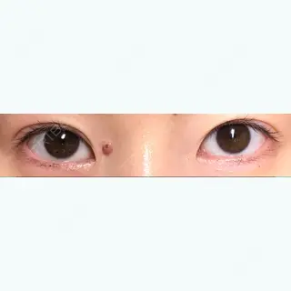 137日目の経過画像（1枚目）