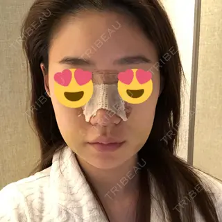 6日目の経過画像（3枚目）