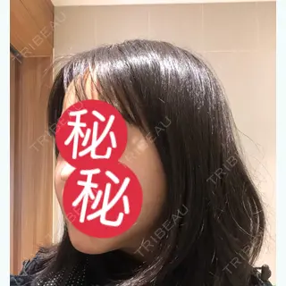 1日目の経過画像（2枚目）