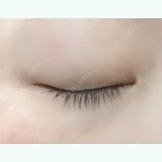 21日目の経過画像（2枚目）
