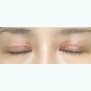 7日目の経過画像（2枚目）
