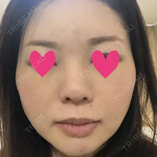 10日目の経過画像（1枚目）