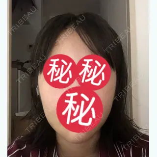 2日目の経過画像（1枚目）