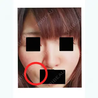 2日目の経過画像（1枚目）