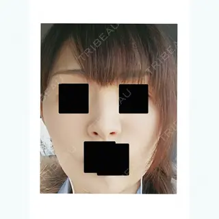 9日目の経過画像（1枚目）