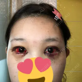3日目の経過画像（1枚目）
