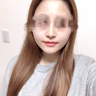 14日目の経過画像（1枚目）