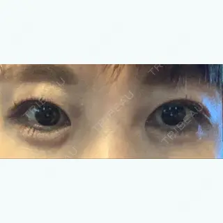 50日目の経過画像（1枚目）