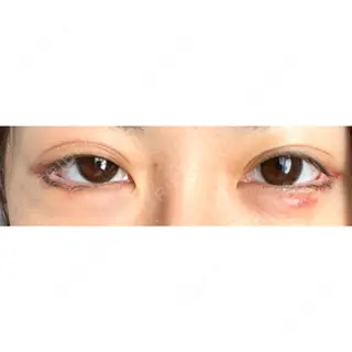 2日目の経過画像（1枚目）