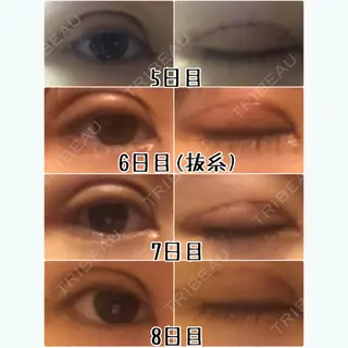 8日目の経過画像（1枚目）