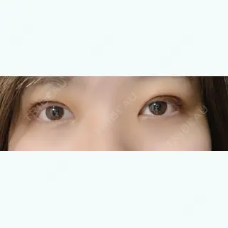 3日目の経過画像（1枚目）