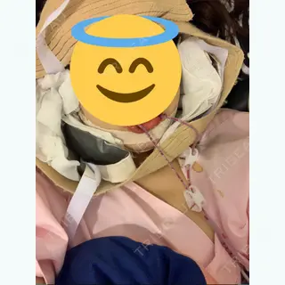 0日目の経過画像（1枚目）
