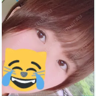 333日目の経過画像（2枚目）