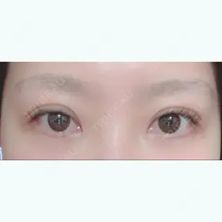 19日目の経過画像（1枚目）
