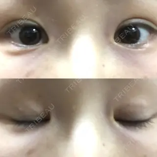 8日目の経過画像（1枚目）