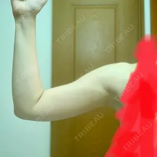 17日目の経過画像（2枚目）
