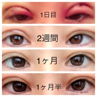 42日目の経過画像（1枚目）