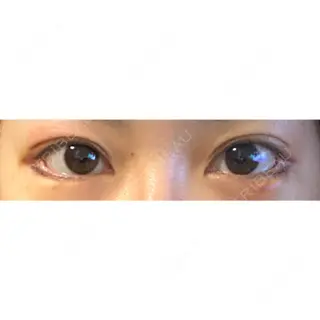 3日目の経過画像（1枚目）