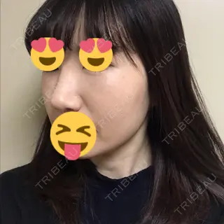 2日目の経過画像（1枚目）