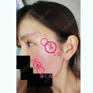 0日目の経過画像（1枚目）