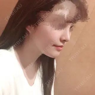 18日目の経過画像（1枚目）