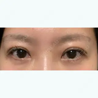 21日目の経過画像（2枚目）
