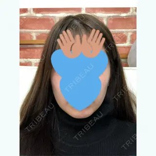 7日目の経過画像（1枚目）