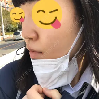8日目の経過画像（2枚目）