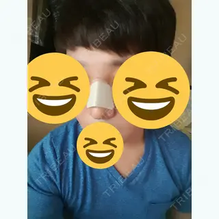 3日目の経過画像（2枚目）