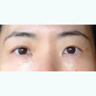 7日目の経過画像（1枚目）