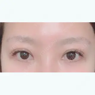 23日目の経過画像（1枚目）