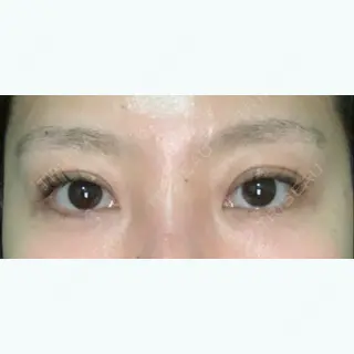 23日目の経過画像（2枚目）