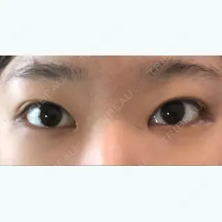 114日目の経過画像（1枚目）