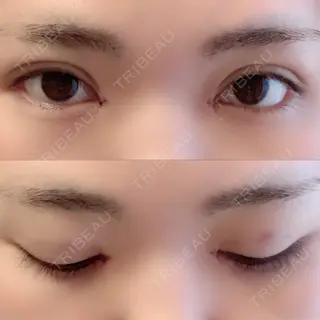 1日目の経過画像（1枚目）