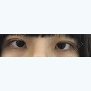 2日目の経過画像（1枚目）