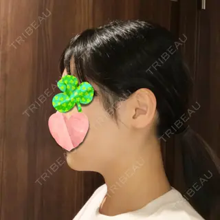 53日目の経過画像（3枚目）