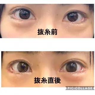9日目の経過画像（1枚目）