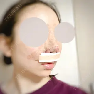 0日目の経過画像（2枚目）