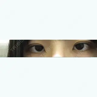 3日目の経過画像（1枚目）