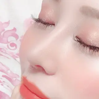 13日目の経過画像（1枚目）