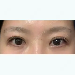 26日目の経過画像（2枚目）