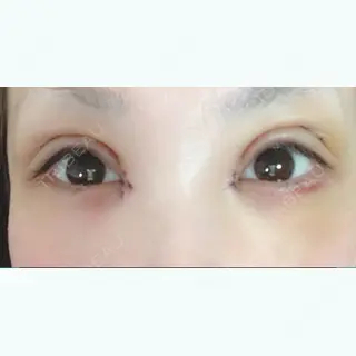 7日目の経過画像（1枚目）