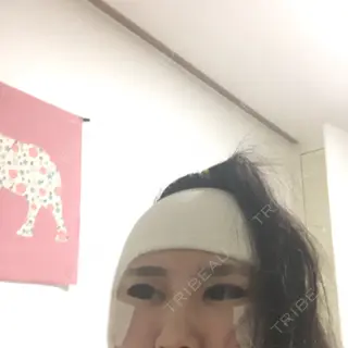 0日目の経過画像（3枚目）