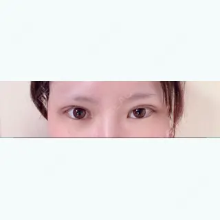 1日目の経過画像（1枚目）