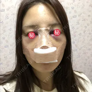 1日目の経過画像（1枚目）