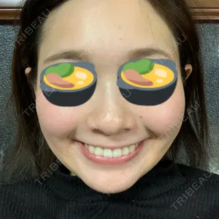 26日目の経過画像（1枚目）