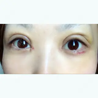 10日目の経過画像（1枚目）